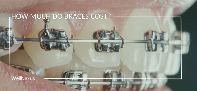 How Much Do Braces Cost?