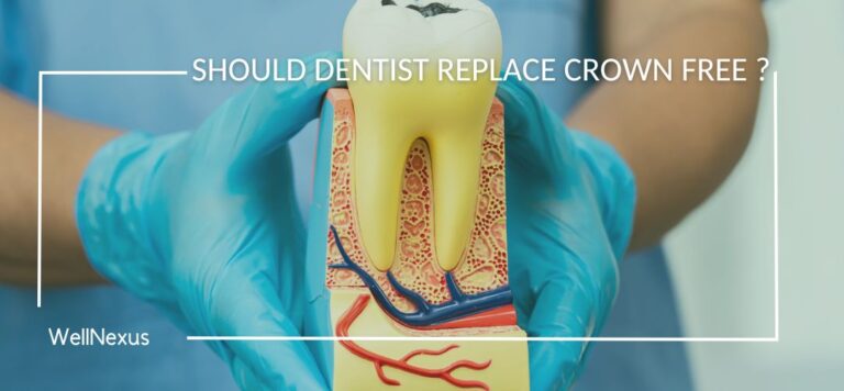 should dentist replace crown free